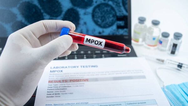 Yucatán solicita vacunas ante aumento de Mpox